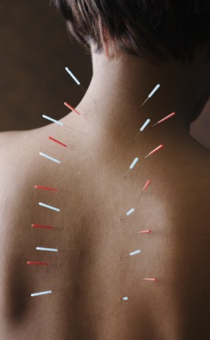 Upper Back Pain  Backcare And Acupuncture Clinic